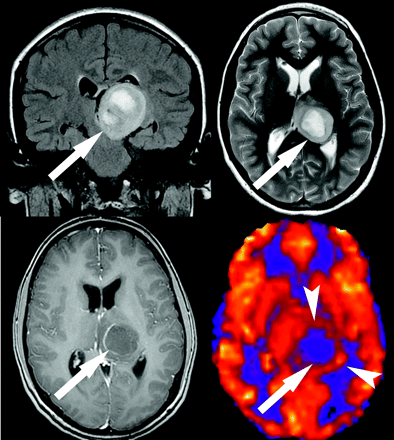 Fig 7.