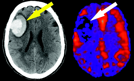 Fig 8.