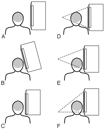 Fig 4.