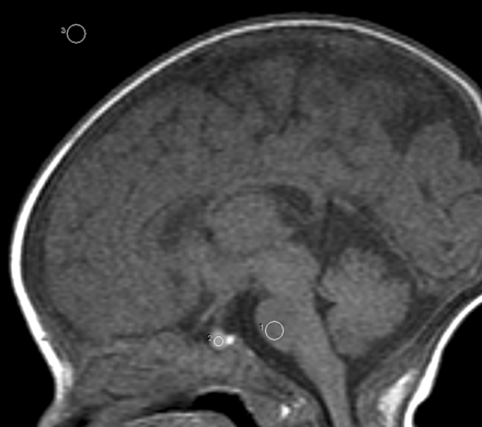 Fig 1.