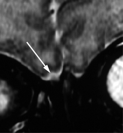 Fig 2.