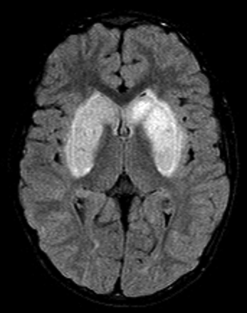 Fig 1.
