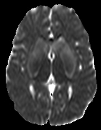Fig 2.