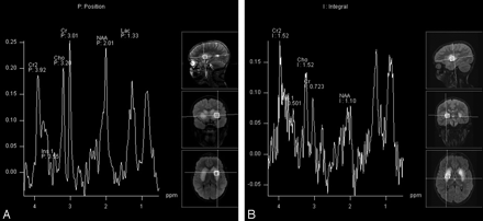 Fig 3.