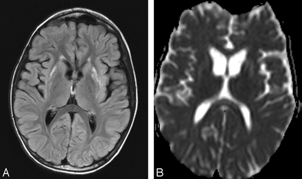 Fig 4.