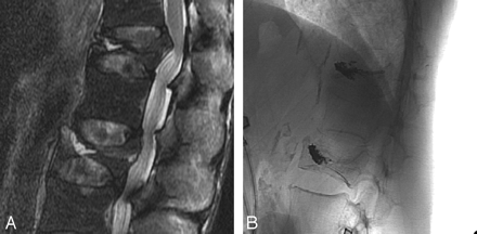Fig 2.