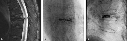 Fig 3.