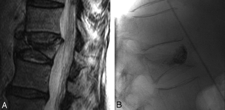 Fig 4.