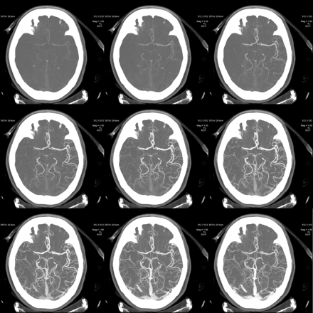 Fig 1.