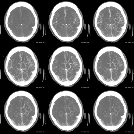 Fig 2.