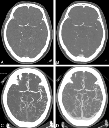 Fig 5.