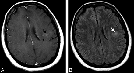 Fig 1.