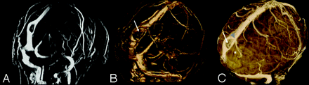 Fig 3.
