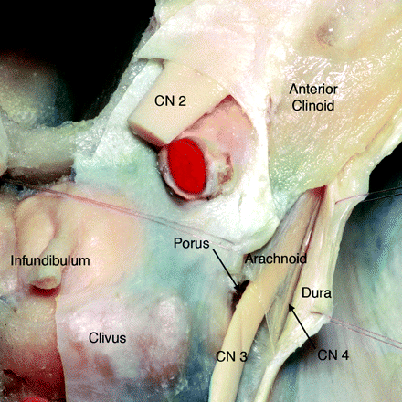 Fig 2.