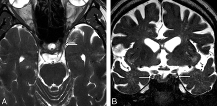 Fig 5.