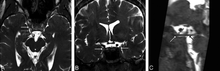 Fig 6.