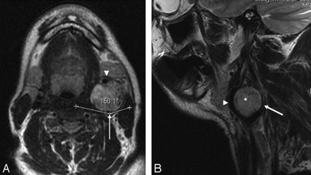 Fig 3.