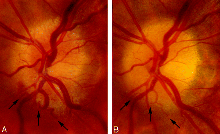 Fig 1.