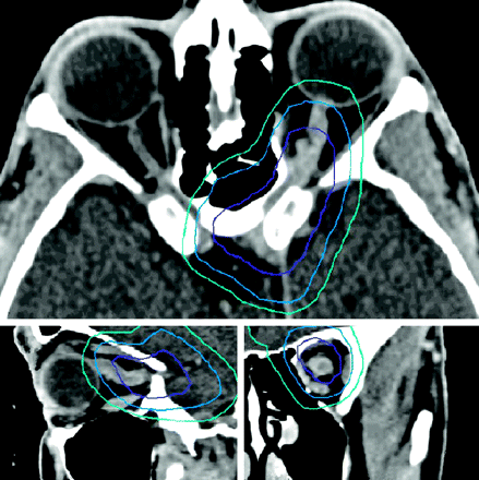 Fig 4.