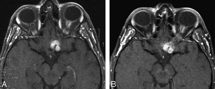 Fig 5.