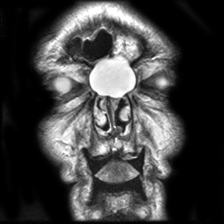 Fig 3.