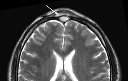 Fig 4.