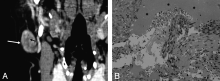 Fig 3.