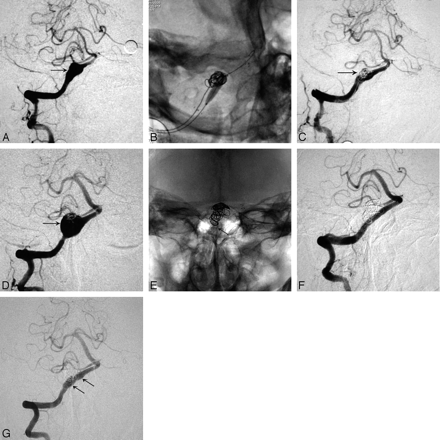 Fig 4.