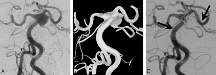 Fig 2.