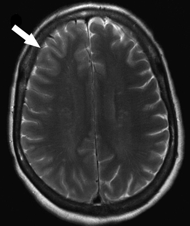 Fig 1.