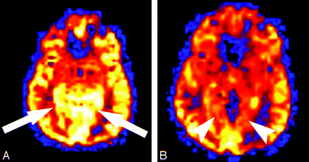 Fig 3.