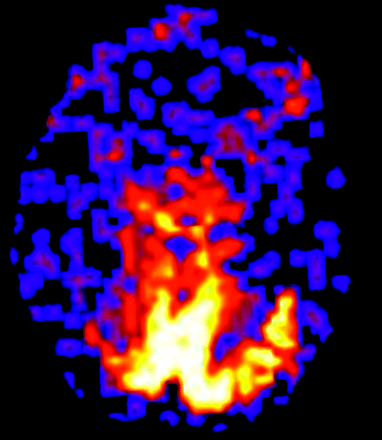 Fig 4.