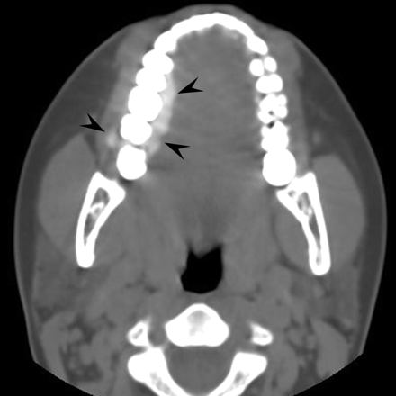 Fig 3.