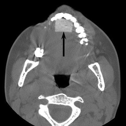 Fig 6.