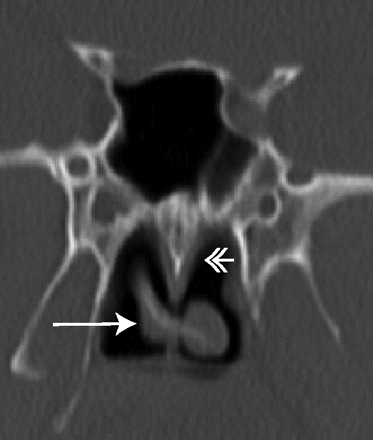 Fig 3.