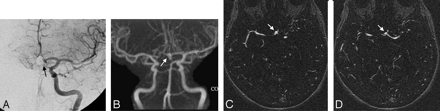 Fig 3.