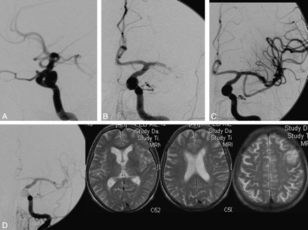 Fig 3.