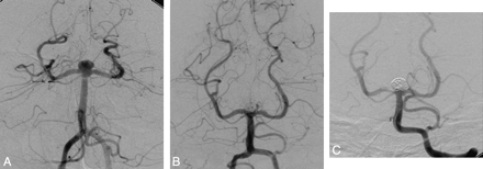 Fig 4.