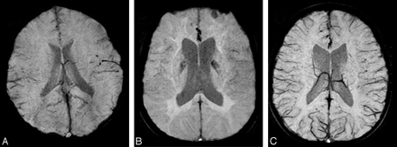   Fig 1. 
