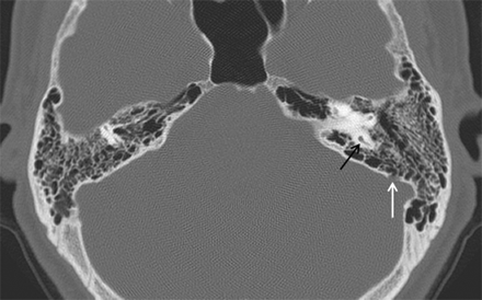 Fig 1.