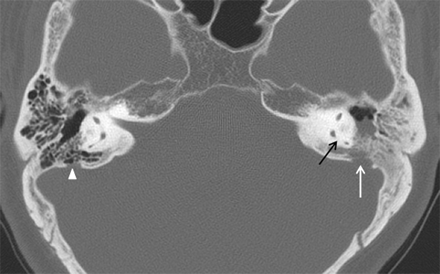 Fig 2.