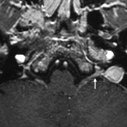Fig 1.