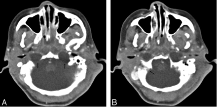 Fig 2.