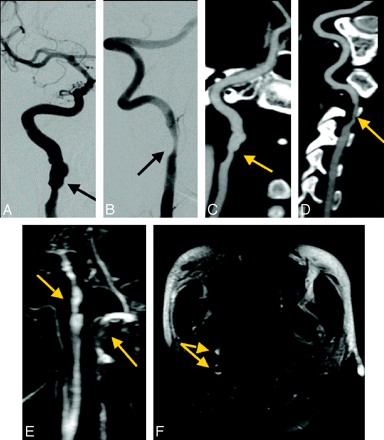 Fig 1.