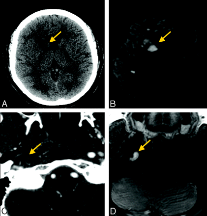 Fig 3.