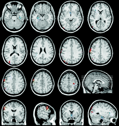 Fig 2.