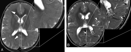 Fig 1.