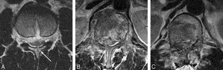 Fig 3.