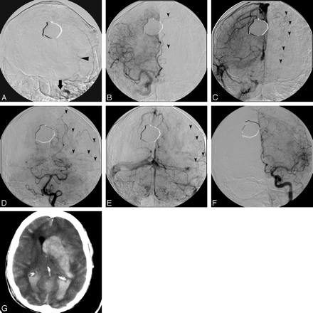 Fig 3.