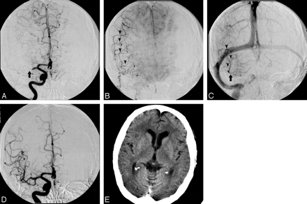 Fig 4.